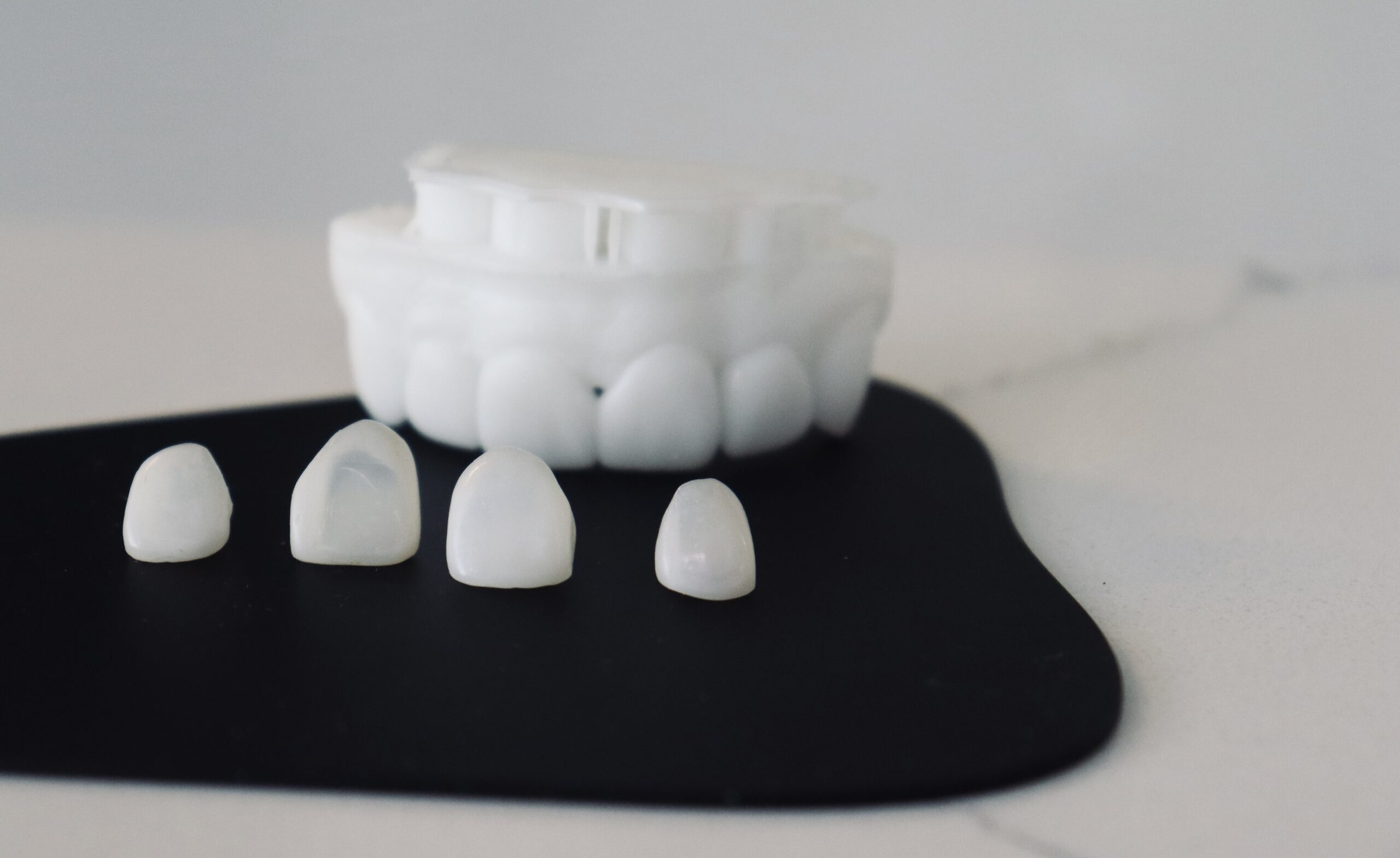 Tratamiento de carillas de porcelana